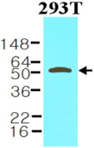 MAB1122 - Visfatin / NAMPT
