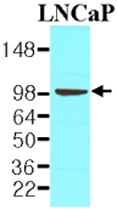 MAB1124 - PSMA / FOLH1