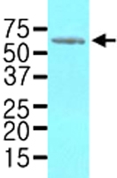 MAB1126 - Heat shock factor 1 / HSF1