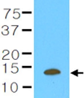 MAB1127 - Cystatin-B