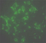 MAB1128 - PSMA / FOLH1