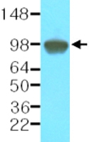 MAB1128 - PSMA / FOLH1