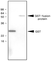 MAB1132 - GST-Tag