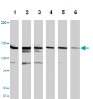 MAB1145 - HGF receptor