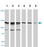 MAB1147 - HGF receptor