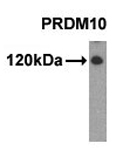 MAB1150 - PRDM10