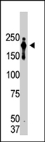 MAB1151 - PRDM2