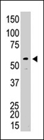 MAB1155 - SRC1