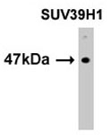 MAB1156 - SUV39H1 / KMT1A