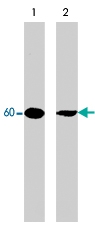 MAB1364 - AKT1 / PKB