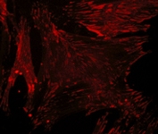 MAB1366 - Paxillin / PXN