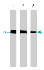 MAB1367 - PRKCG