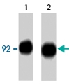 MAB1369 - Catenin beta-1