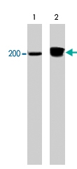 MAB1371 - CD104 / Integrin beta-4