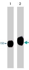 MAB1377 - PLCG1