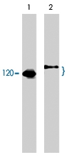 MAB1378 - CBL / RNF55