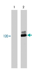 MAB1380 - CBL / RNF55