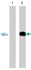 MAB1382 - EGFR / ERBB1