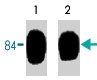 MAB1383 - Junction plakoglobin