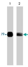 MAB1389 - PRKCQ / PRKCT
