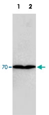 MAB1514 - Collagen type III alpha 1 chain