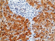 MAB1627 - NOS2