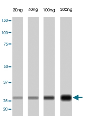 MAB1641 - Trypsin-1 / PRSS1