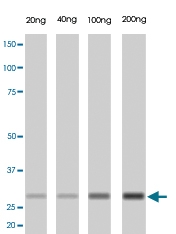 MAB1642 - Trypsin-1 / PRSS1
