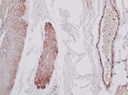 MAB1644 - Actin beta / ACTB