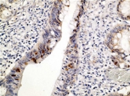 MAB1645 - TP53 / p53