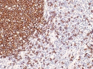MAB1648 - CD20