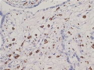 MAB1652 - CD163