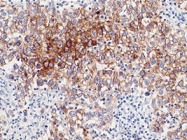 MAB1653 - Alkaline phosphatase / PLAP / ALPP
