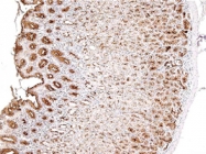 MAB1654 - CD227 / Mucin-1 / MUC1