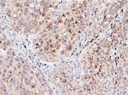 MAB1655 - Melanoma gp100