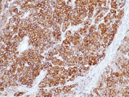 MAB1656 - MART-1