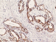 MAB1657 - Cytokeratin 7