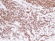 MAB1658 - Estrogen receptor alpha