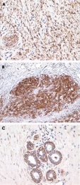 MAB1659 - S100A1