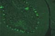 MAB1667 - LGI4