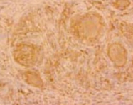MAB1710 - CD204
