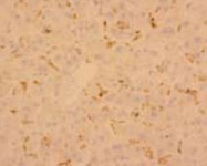 MAB1710 - CD204