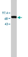 MAB1710 - CD204