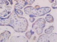 MAB1711 - CD98LC / SLCA5