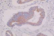 MAB1711 - CD98LC / SLCA5