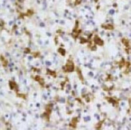 MAB1715 - CD68