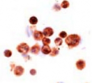 MAB1716 - CD204