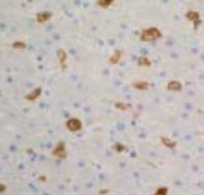 MAB1716 - CD204