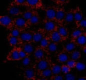 MAB1726 - AZIN1