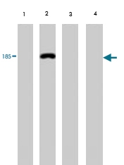 MAB1727 - Vitellogenin
